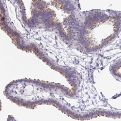 PINLYP Antibody, Novus Biologicals:Antibodies:Primary Antibodies